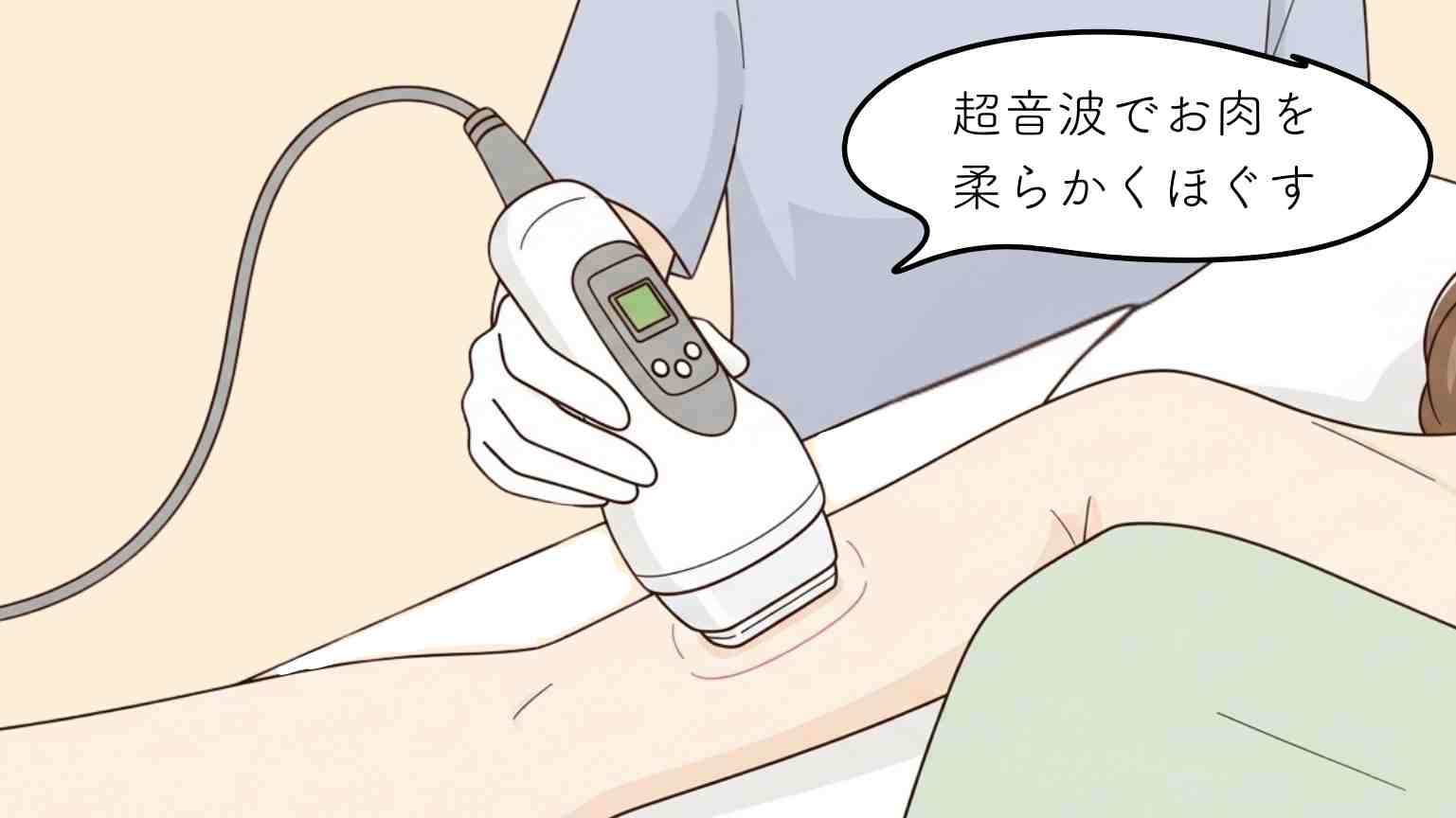 キャビテーション